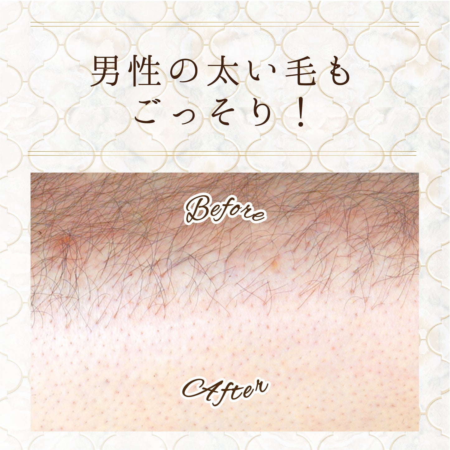 スリンキータッチ セルフスパ 除毛クリーム しっとりタイプ / すべすべタイプ
