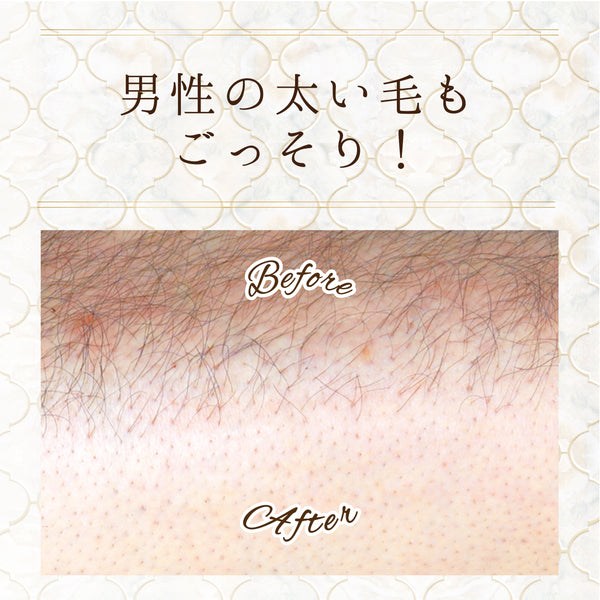 スリンキータッチ セルフスパ 除毛クリーム しっとりタイプ / すべすべタイプ - メディア 14