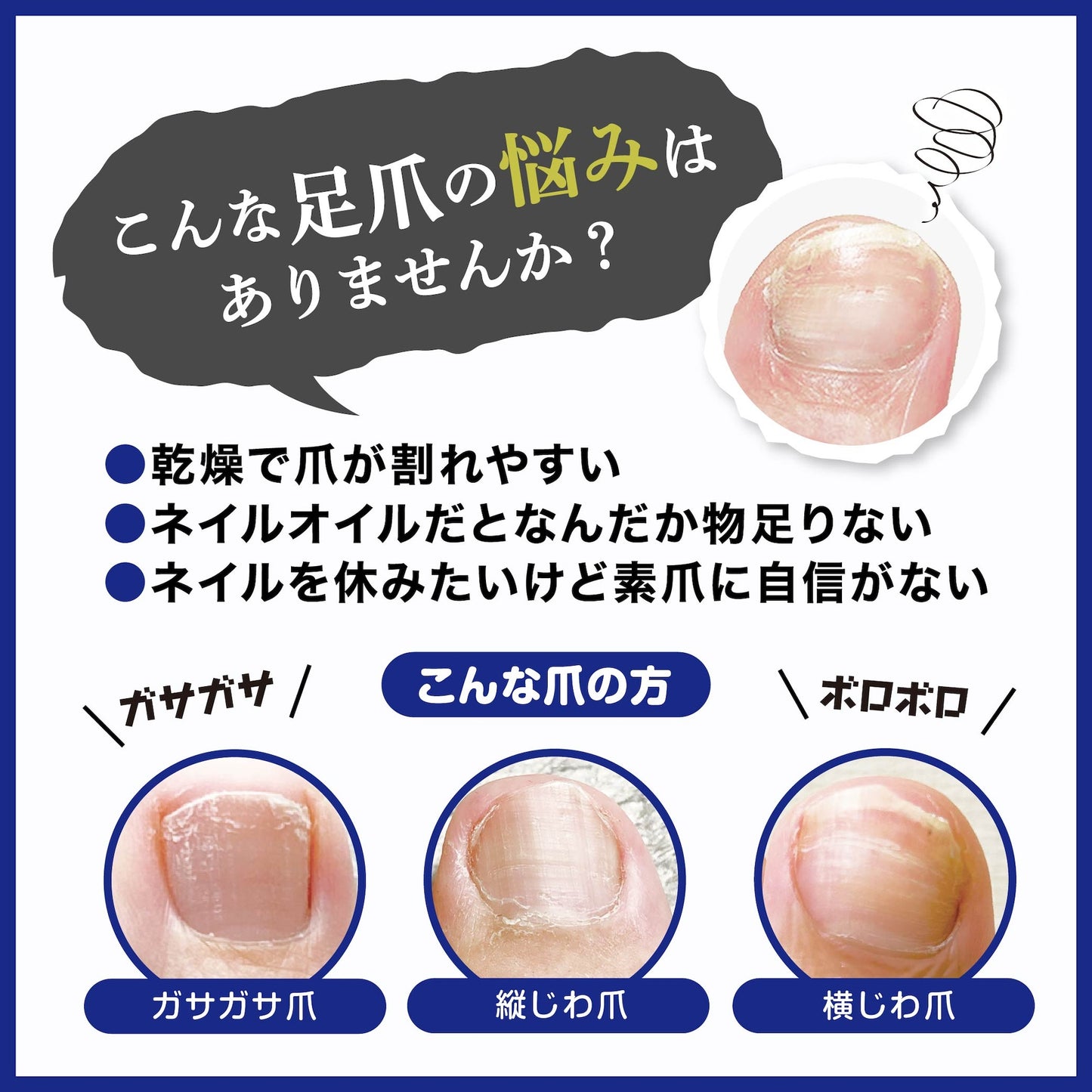 ベビーフット 足爪プロティンパック