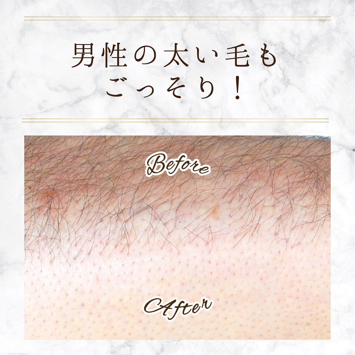 スリンキータッチ セルフスパ 除毛クリーム メンズ