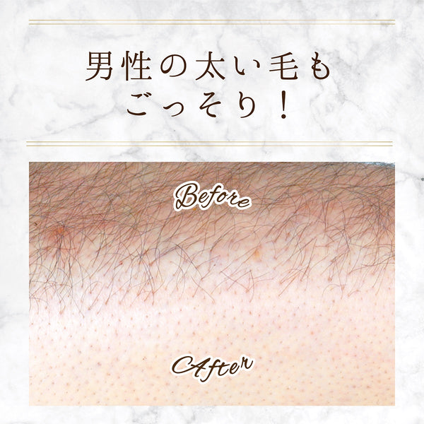 スリンキータッチ セルフスパ 除毛クリーム メンズ - メディア 12
