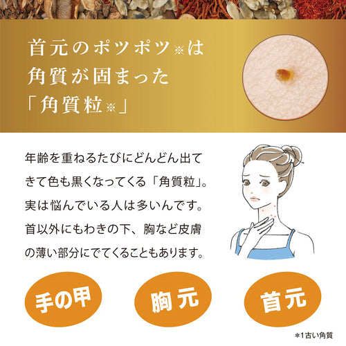 つぶぽろんEX - メディア 3